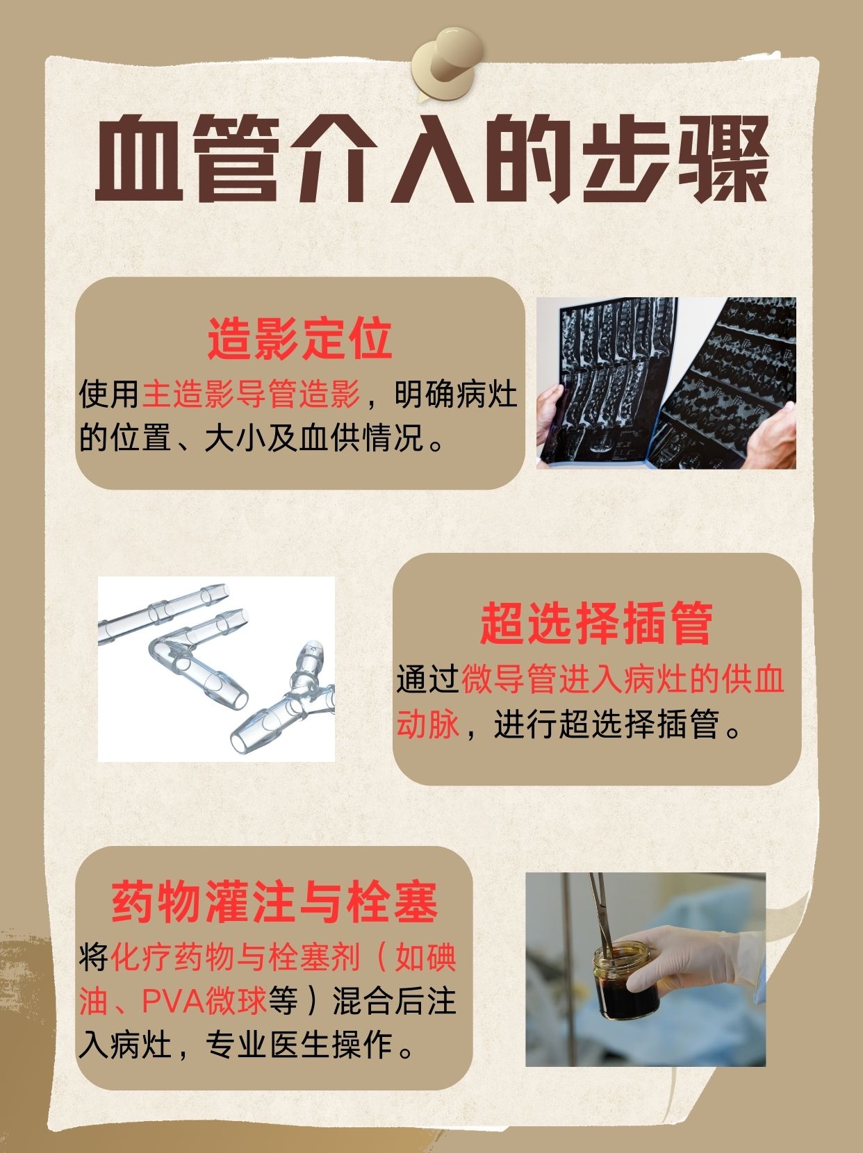 癌症介入治疗什么意思？一文解答