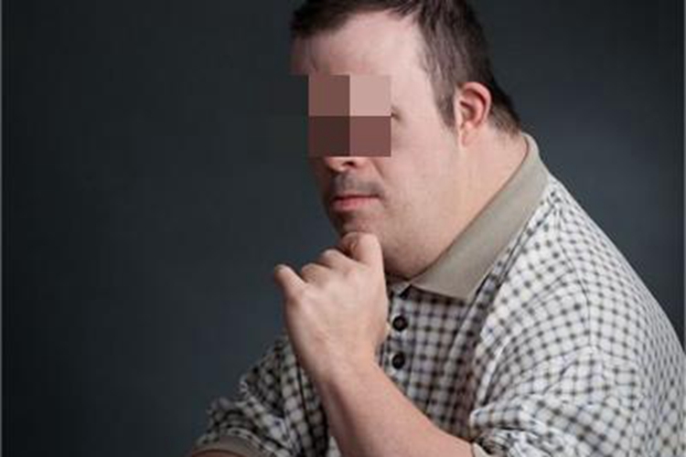 唐氏综合征颈部症状图