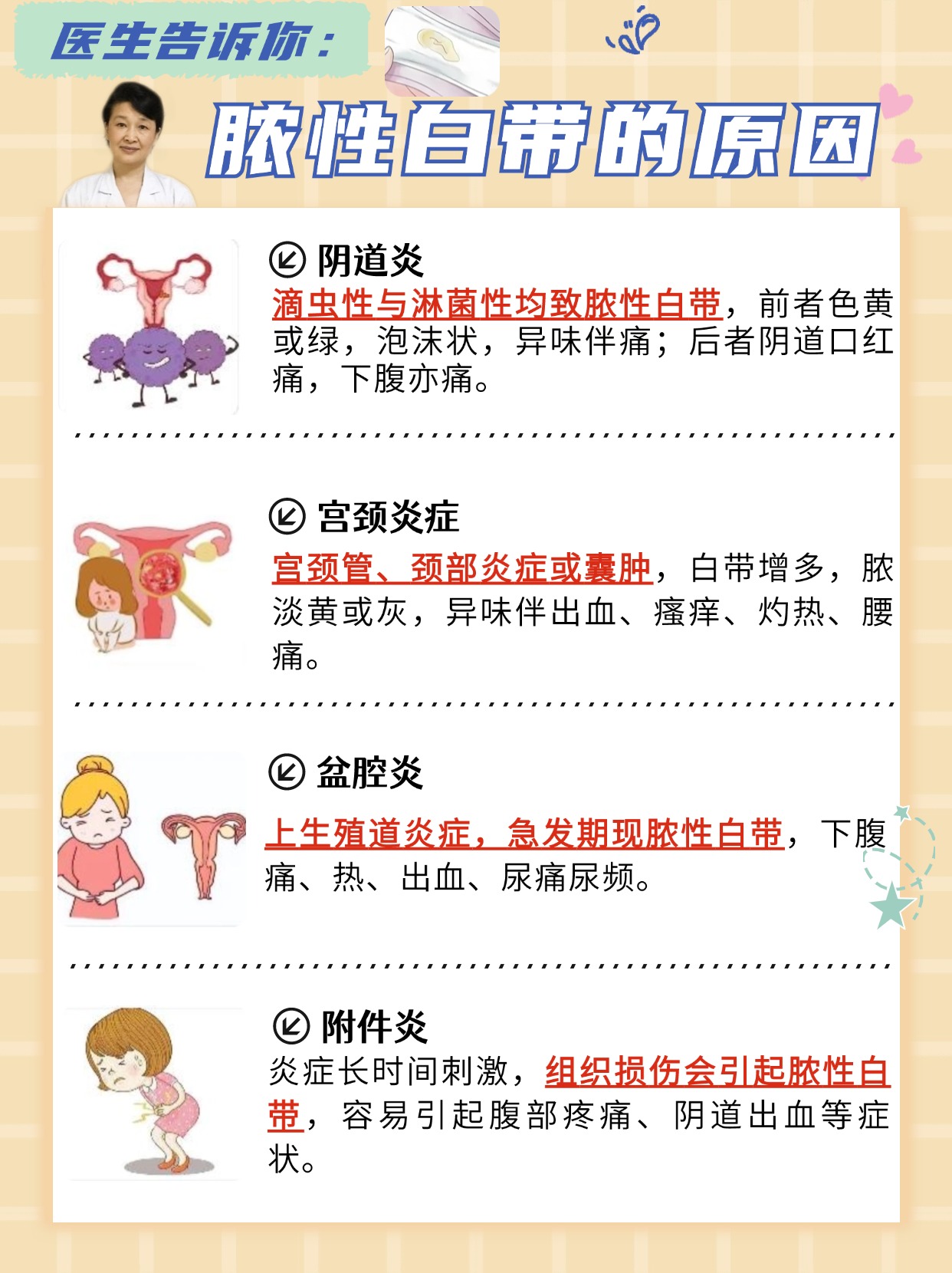 医生告诉你：脓性白带的原因