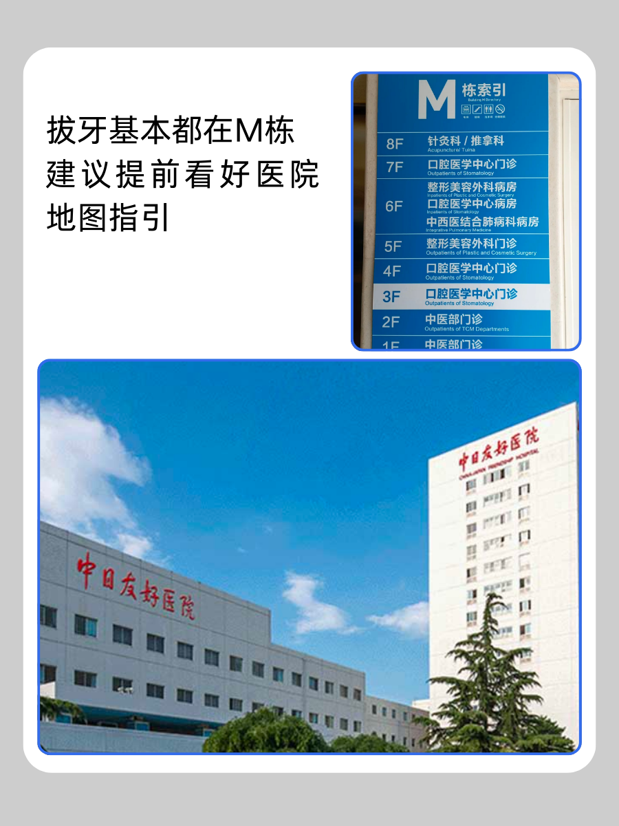 中日友好医院胡倩医生怎么样？怎么挂号？