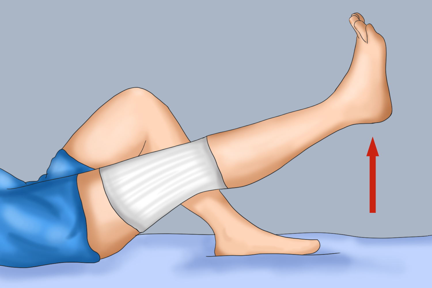 髌骨骨折术后直腿抬高图