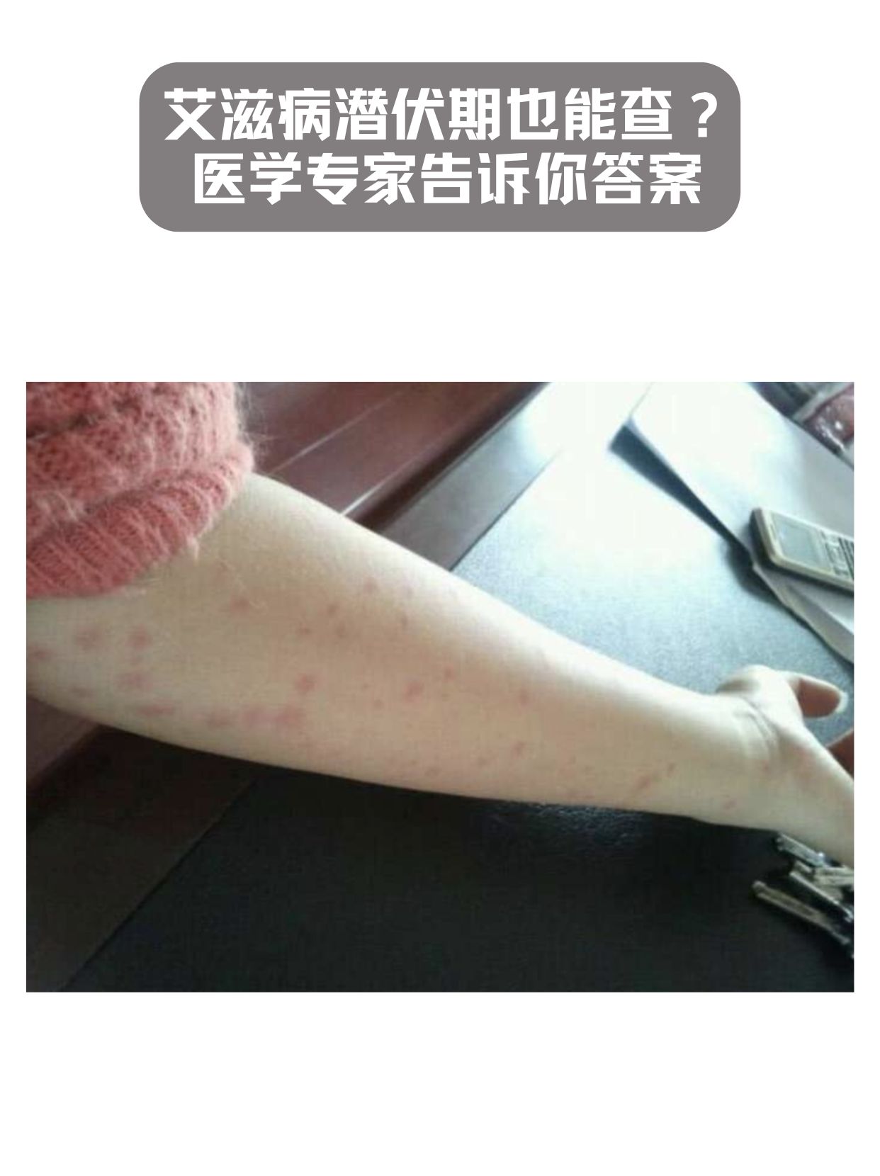 艾滋病潜伏期也能检查出来吗？这里有答案