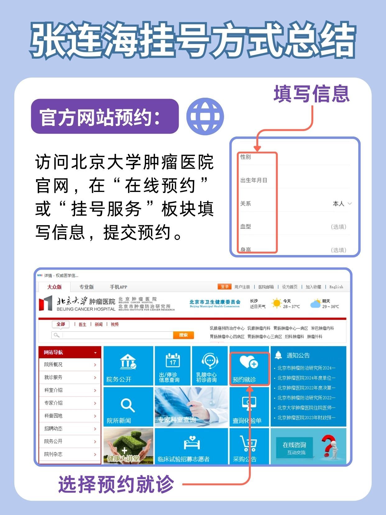 北京肿瘤医院张连海怎么样？怎么挂号？