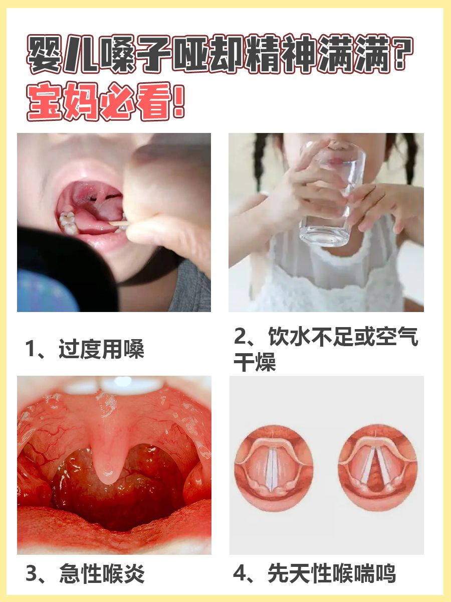 婴儿嗓子哑却精神满满？宝妈必看！