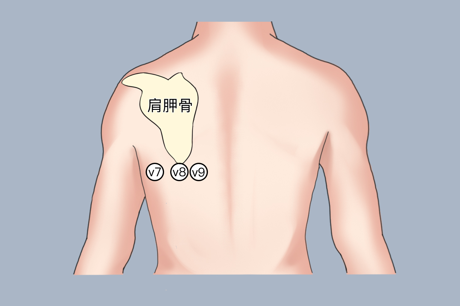 V7-V9导联连接图