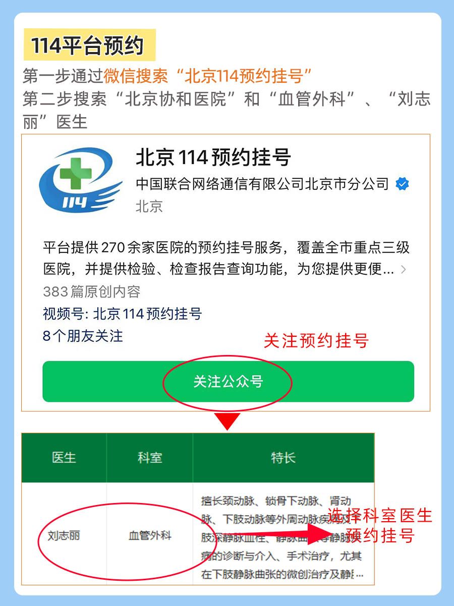 北京协和医院刘志丽医生怎么样？怎么挂号？