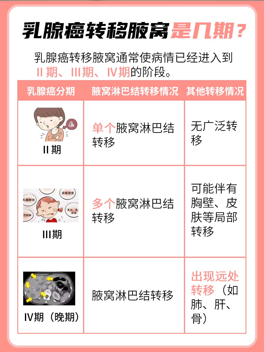 揭秘！乳腺癌转移到腋窝，它悄悄到了几期？
