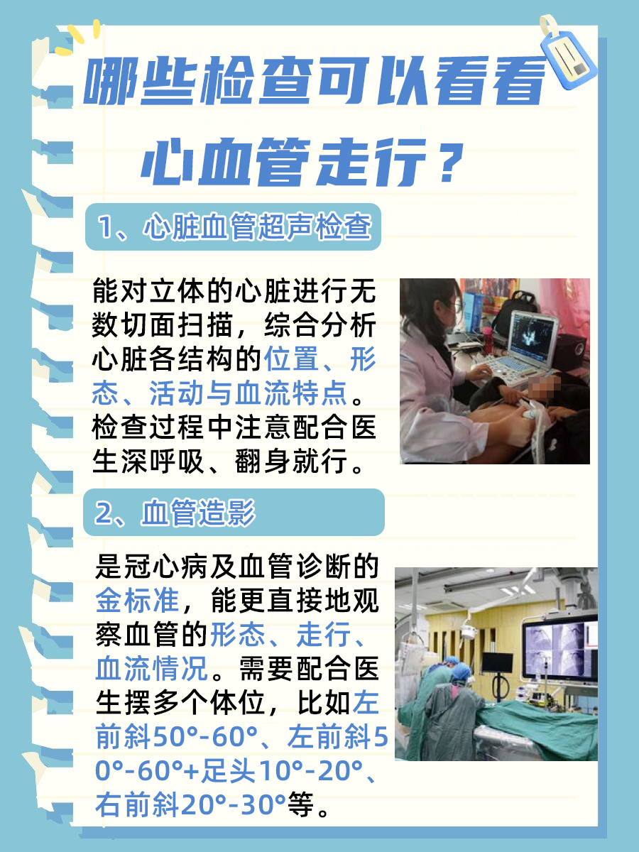 心脏血管揭秘：前降支走行路径