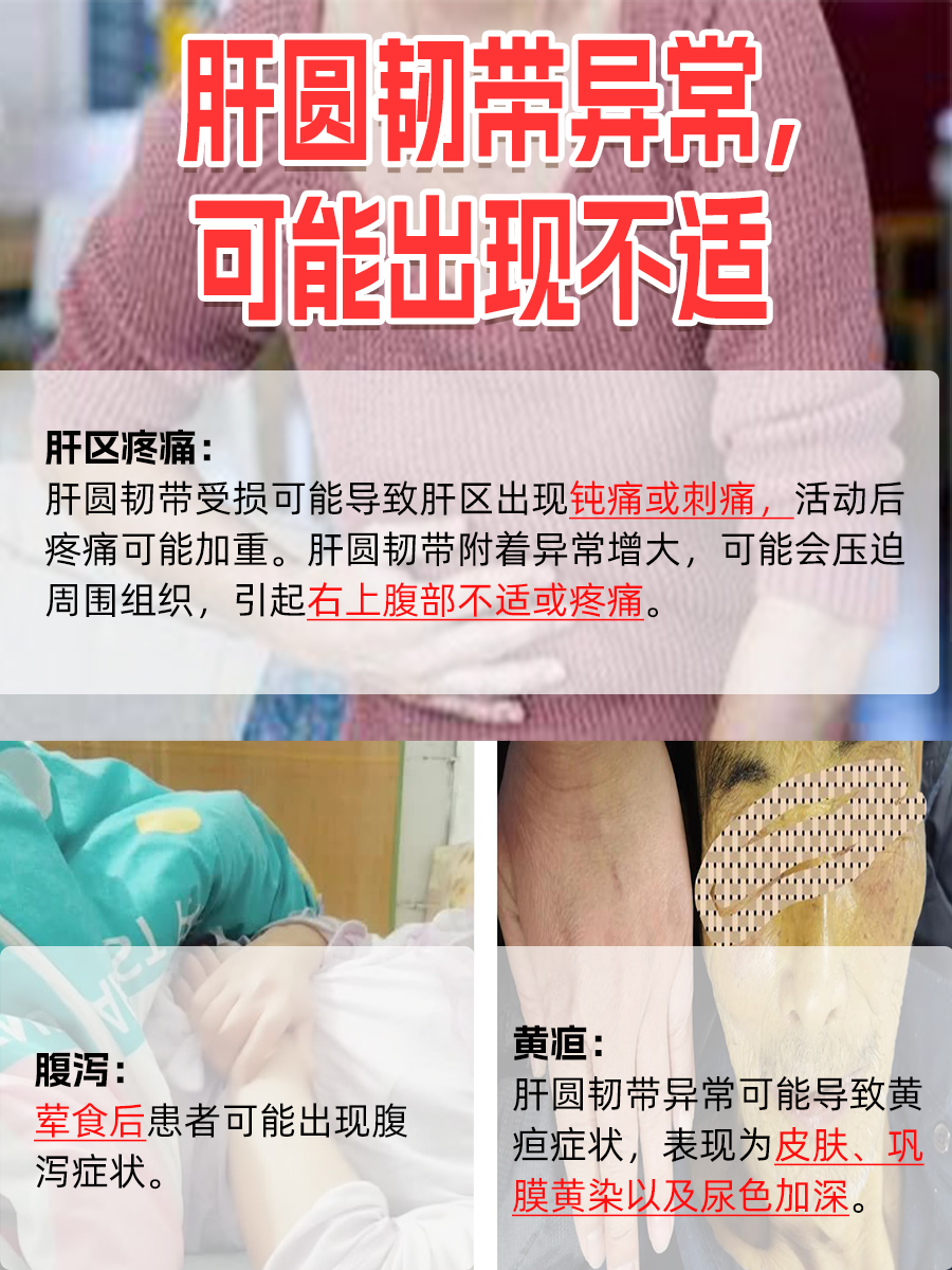 生命纽带：探究肝圆韧带的由来