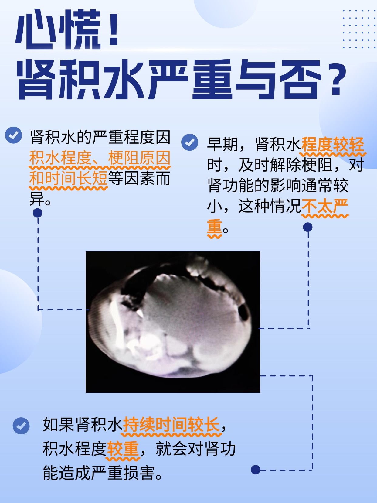 肾积水究竟为何病？其严重性你可知？