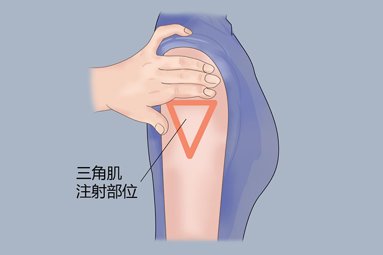 上臂三角肌注射部位图