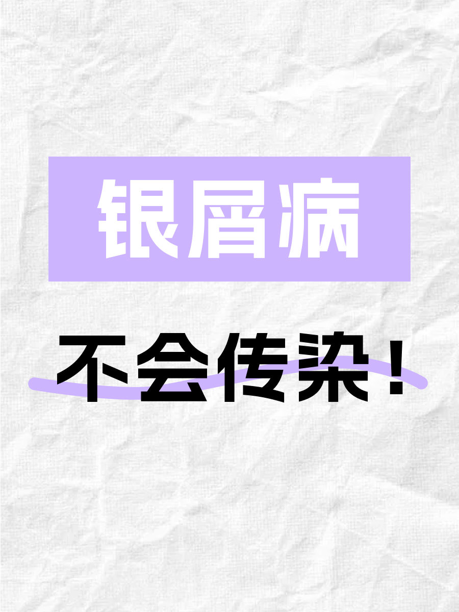 银屑病会不会传染给别人？皮肤科医生来辟谣