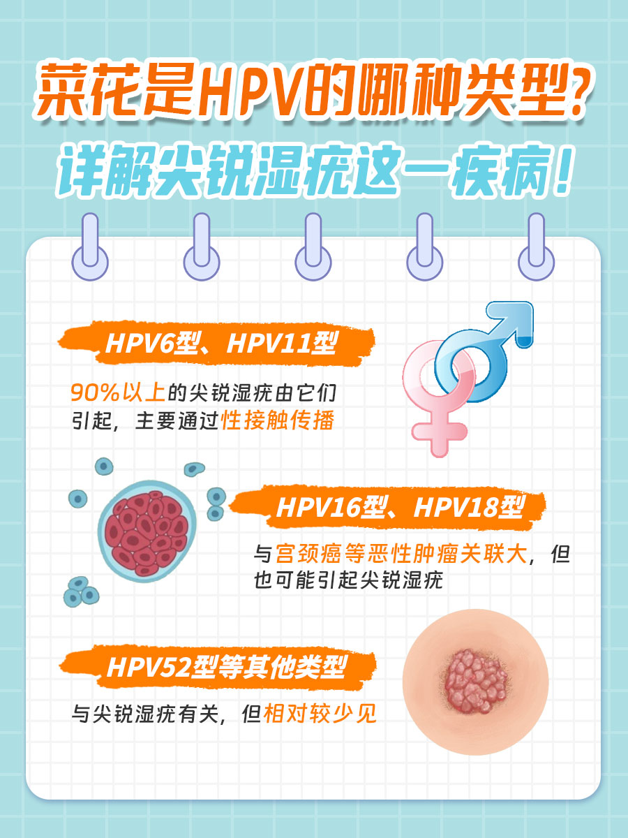 医生详解：外阴菜花是HPV的哪种类型？