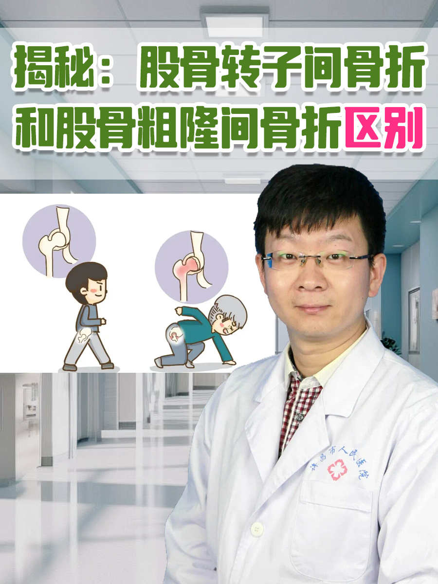 揭秘:股骨转子间骨折和股骨粗隆间骨折区别