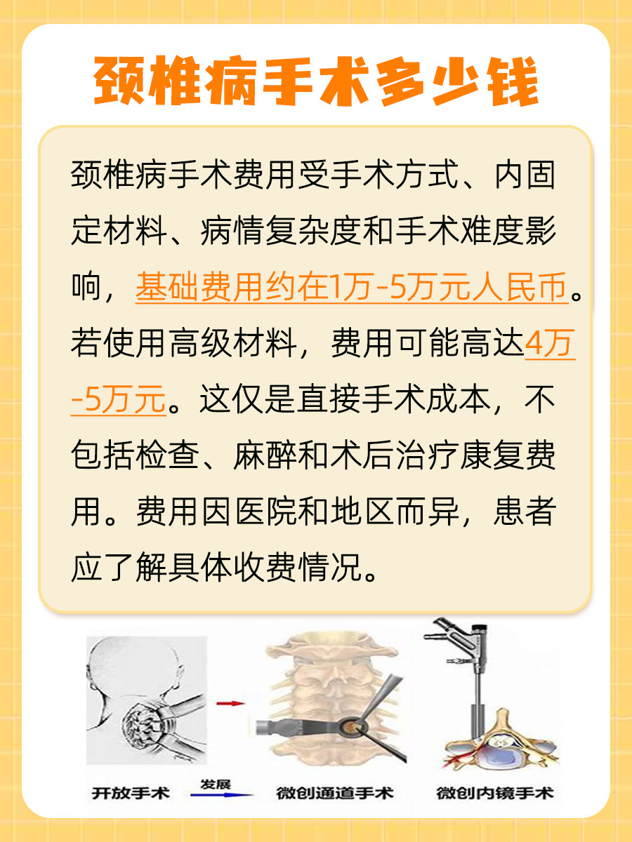 颈椎病手术费用大揭秘，别再花冤枉钱！