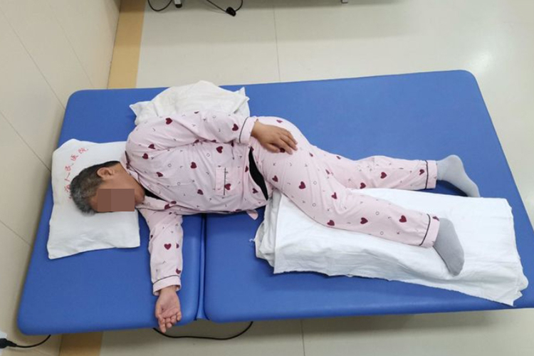 偏瘫患者患侧卧位姿势图 偏瘫患者患侧卧位姿势图
