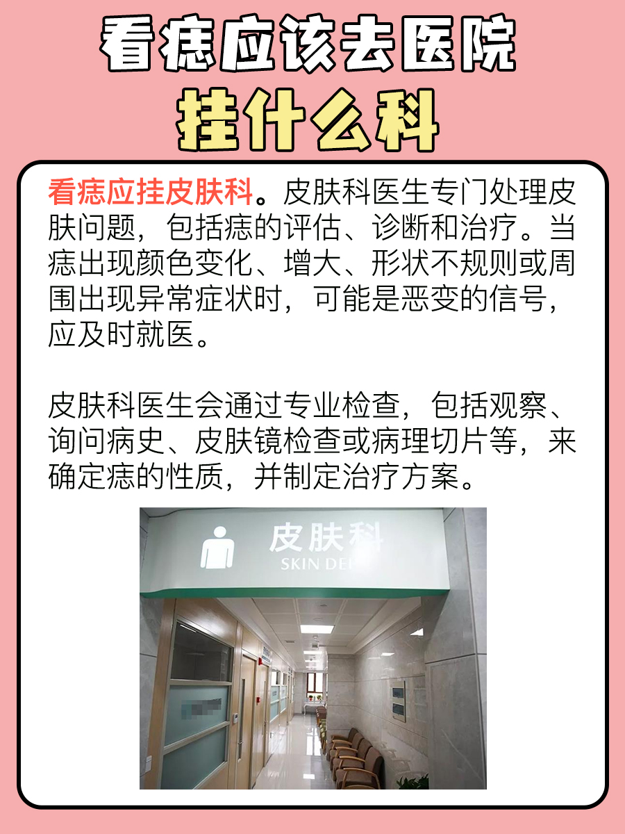 医生解答：看痣你需要挂哪个科？