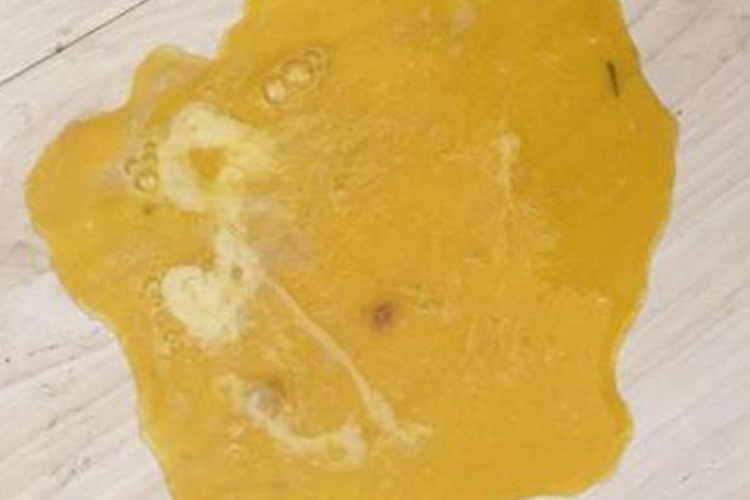 呕吐出金黄色胆汁图 呕吐出金黄色胆汁图