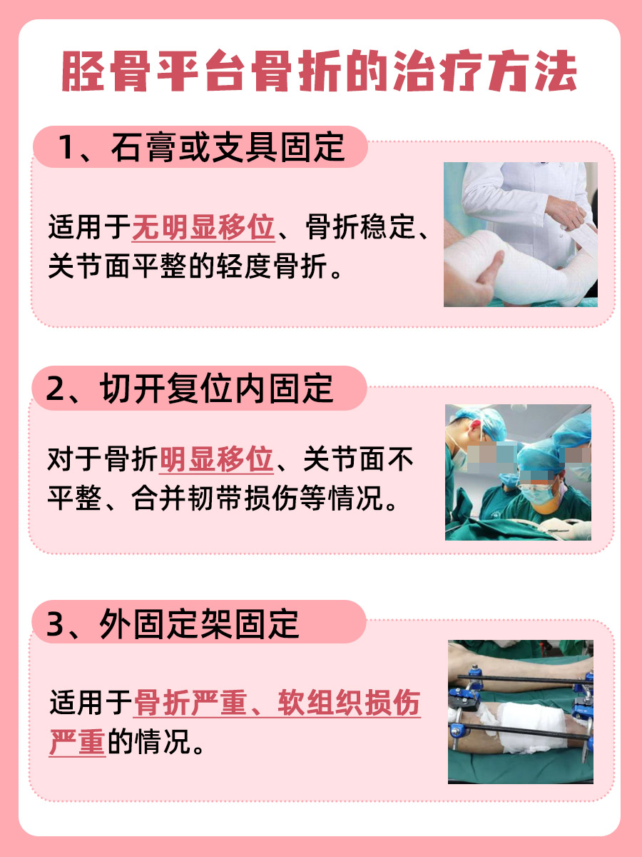 骨科医生揭秘：胫骨平台骨折分型全攻略