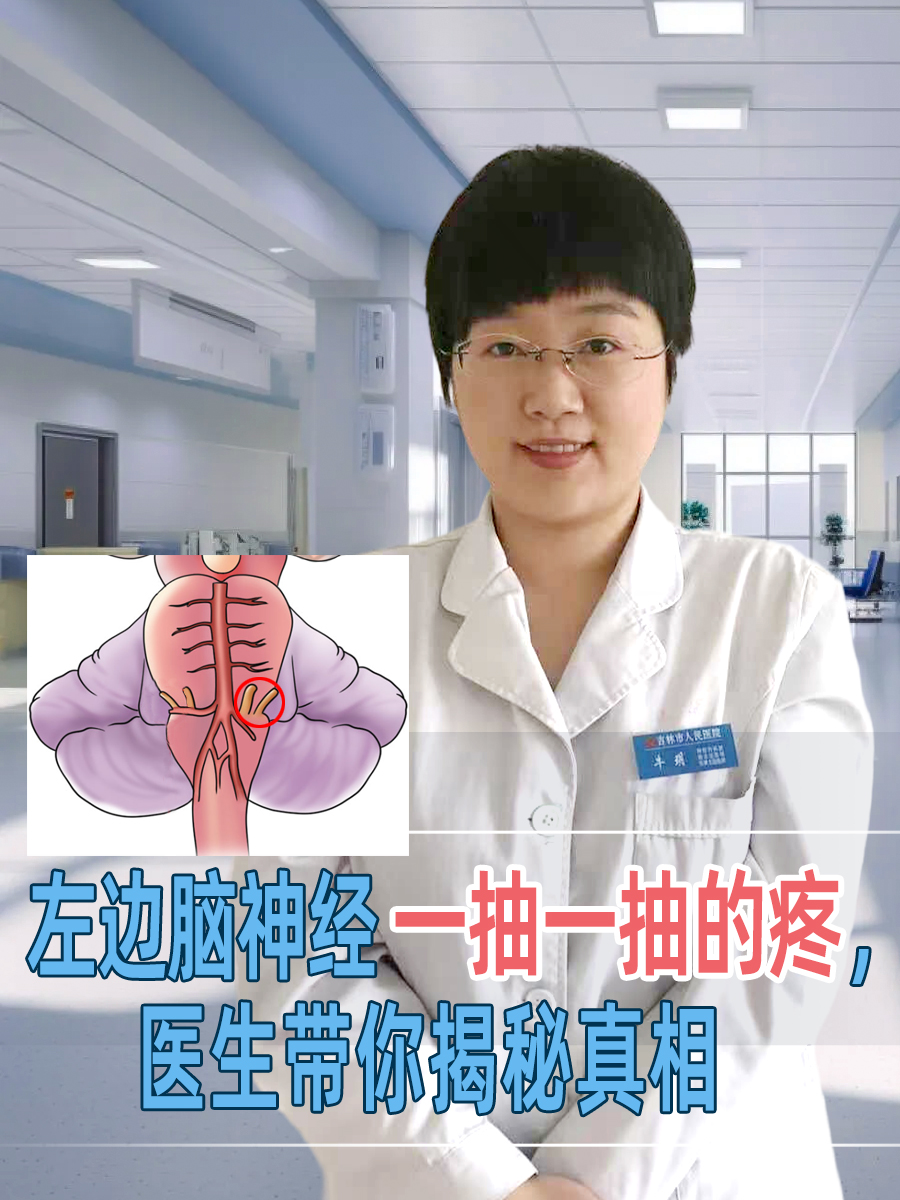 左边脑神经一抽一抽的疼,医生带你揭秘真相