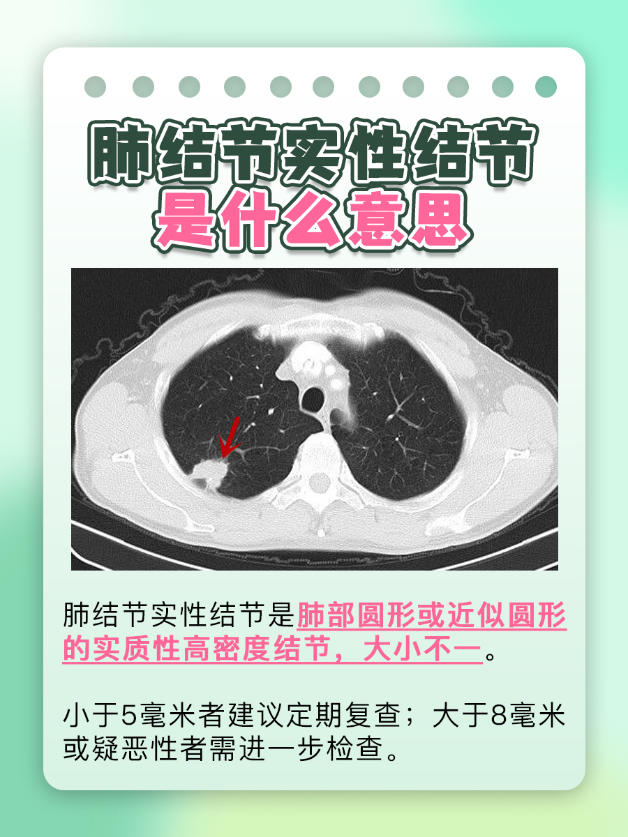 肺结节实性结节是什么意思，一看便知