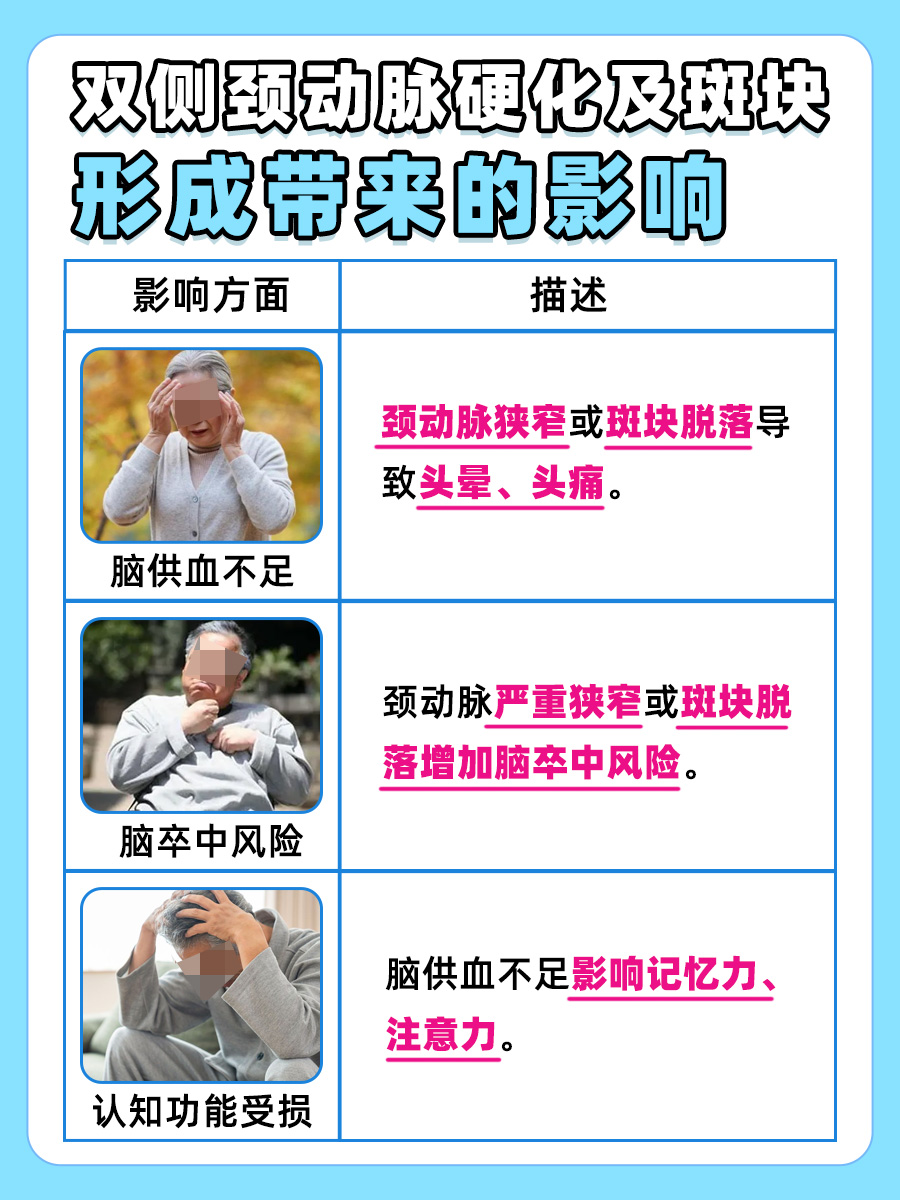 双侧颈动脉硬化及斑块形成的原因与影响解析