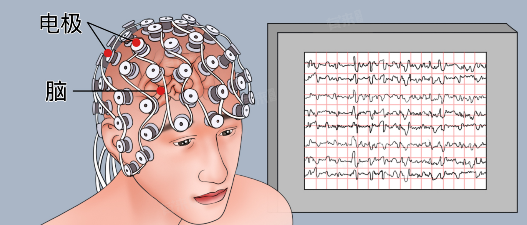 界限性脑电图是什么意思-有来医生