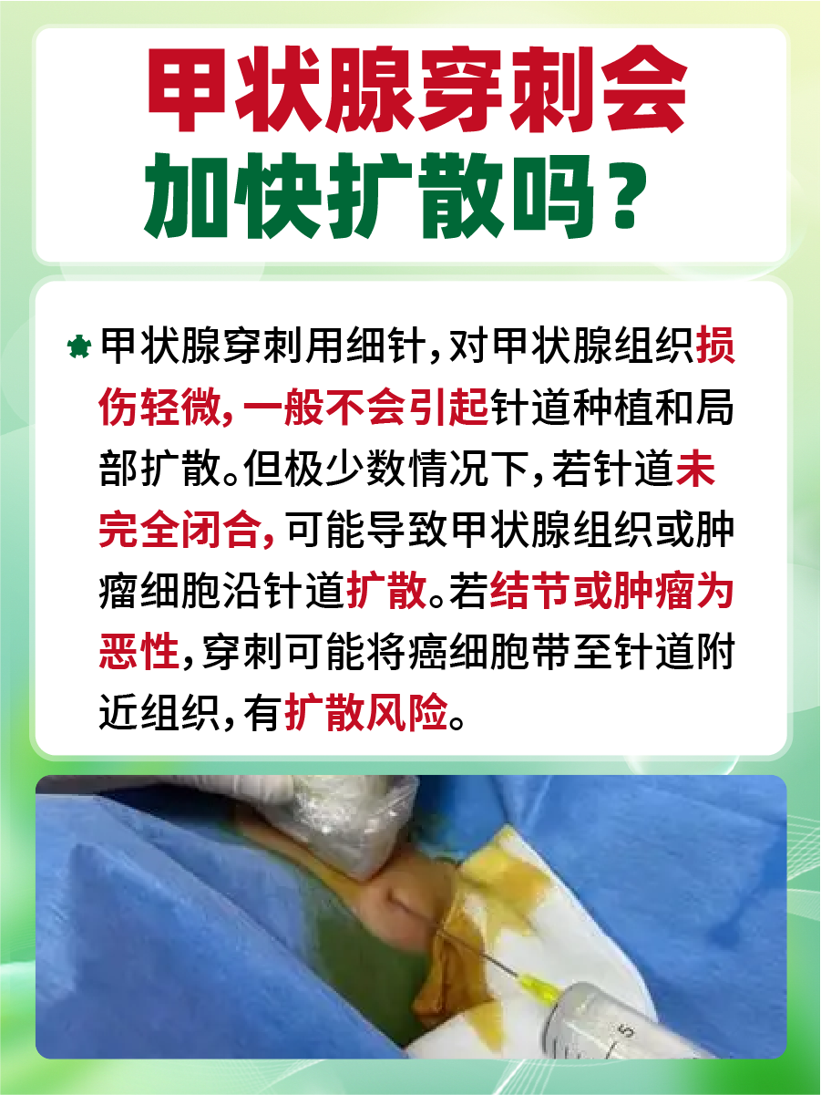 医生解答：甲状腺穿刺会加快扩散吗？