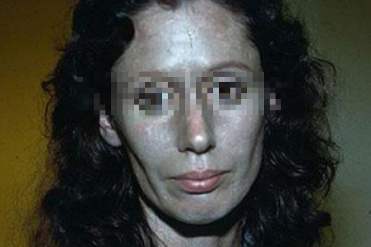 卟啉病紫鱼面容图