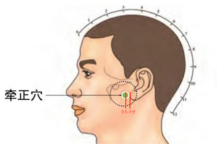 牵正的准确位置图