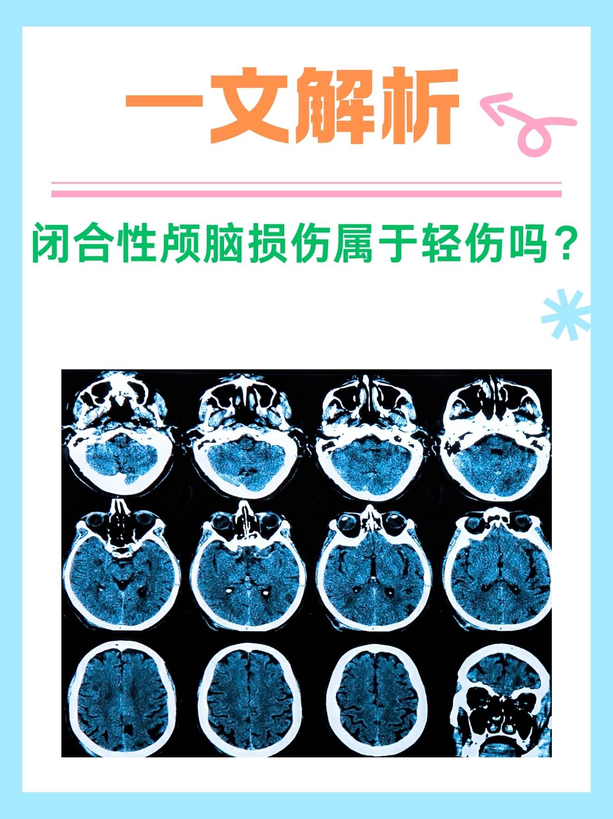 一文解析：闭合性颅脑损伤属于轻伤吗？