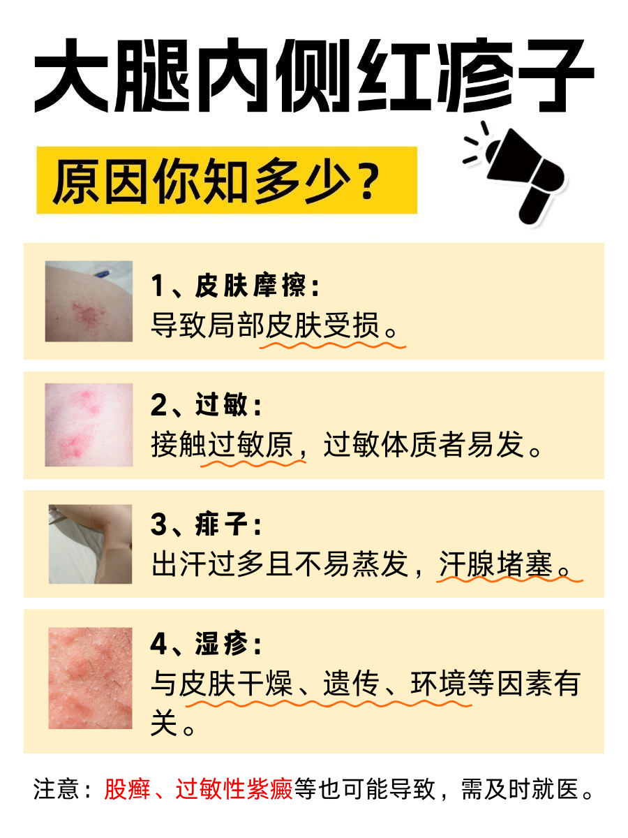 宝妈必看！孩子大腿内侧红疹子，真相在这里！