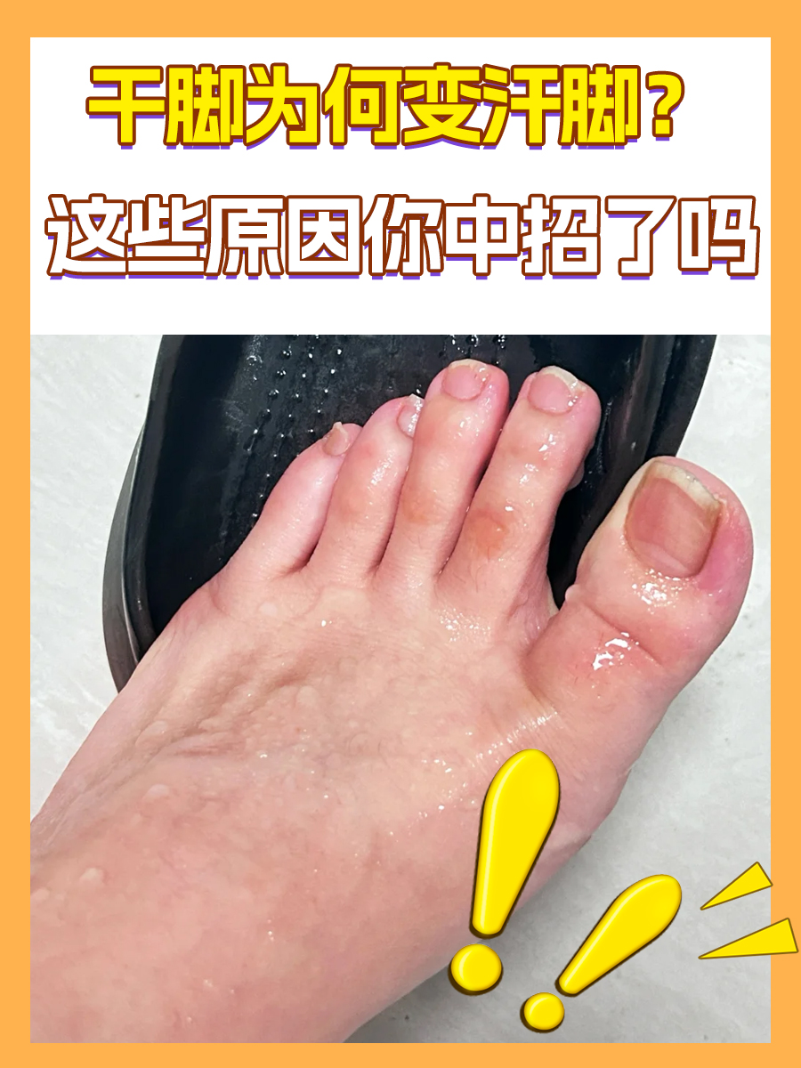 干脚为何变汗脚?这些原因你中招了吗
