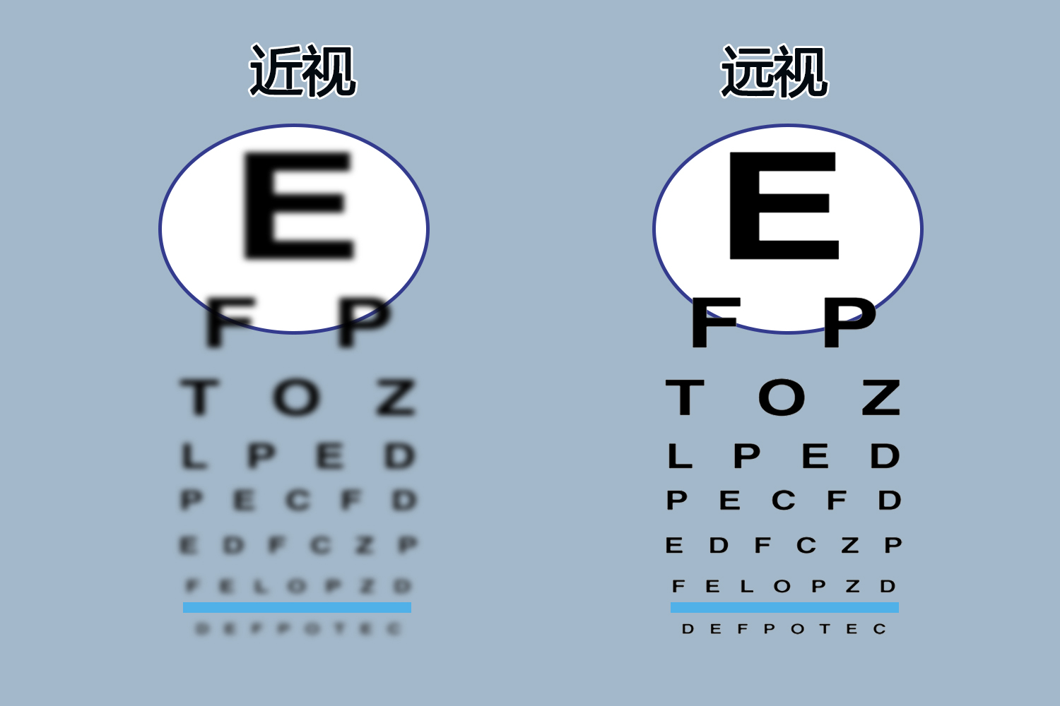 近视与远视的区别图