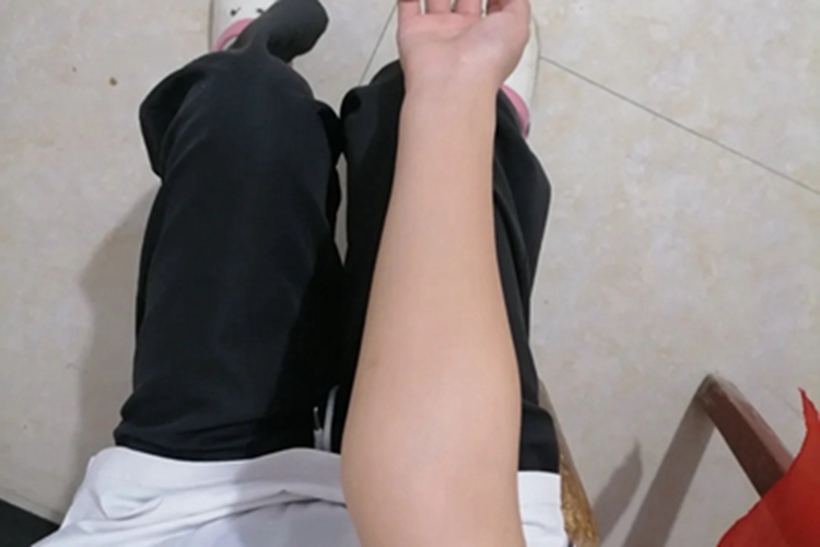 肘外翻前臂向外侧弯曲图