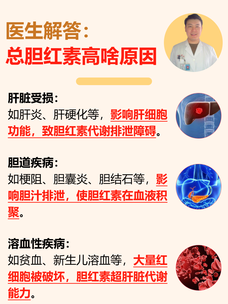 医生解答：总胆红素高啥原因