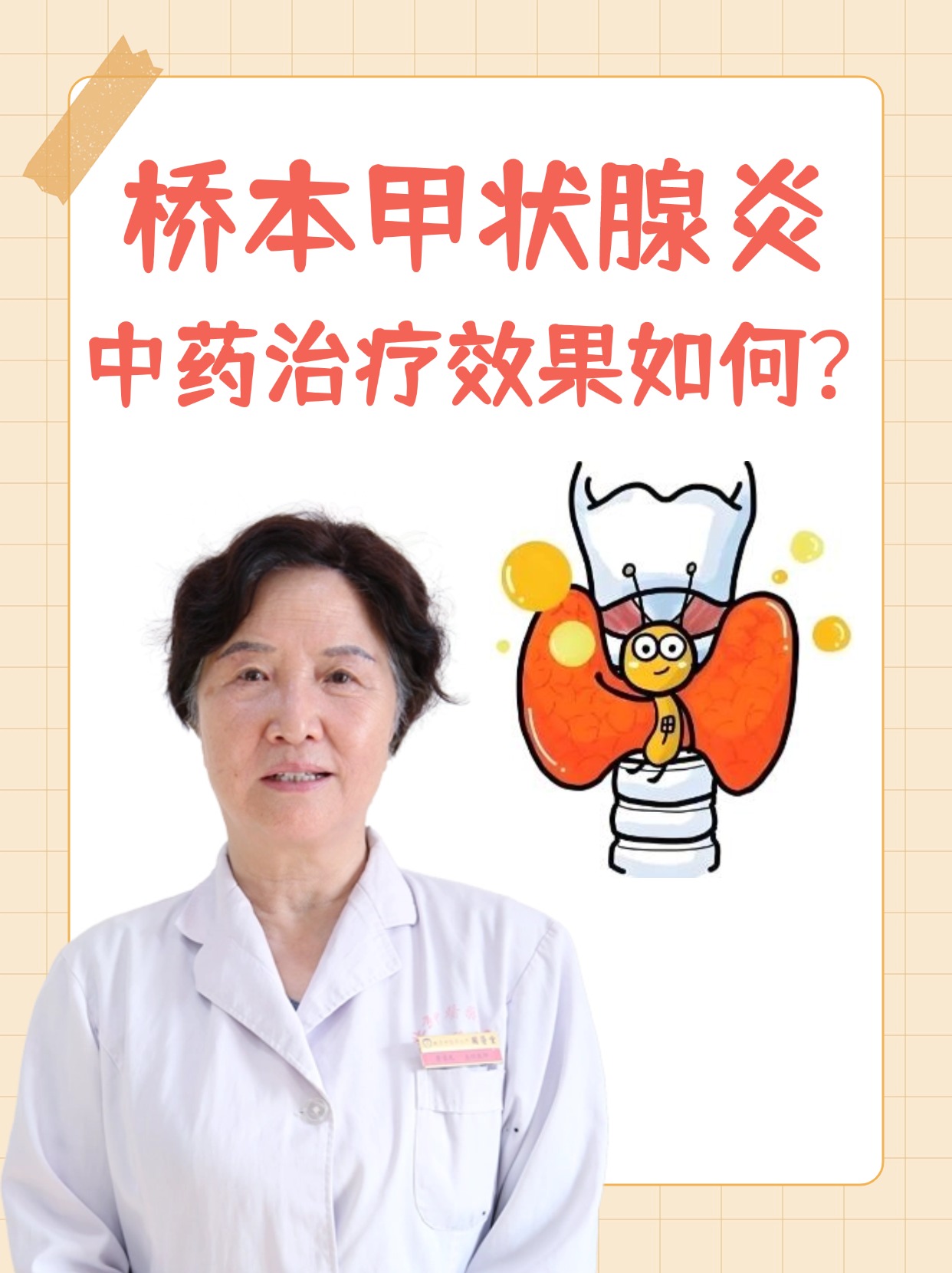 医生揭秘：桥本甲状腺炎，中药治疗效果如何？