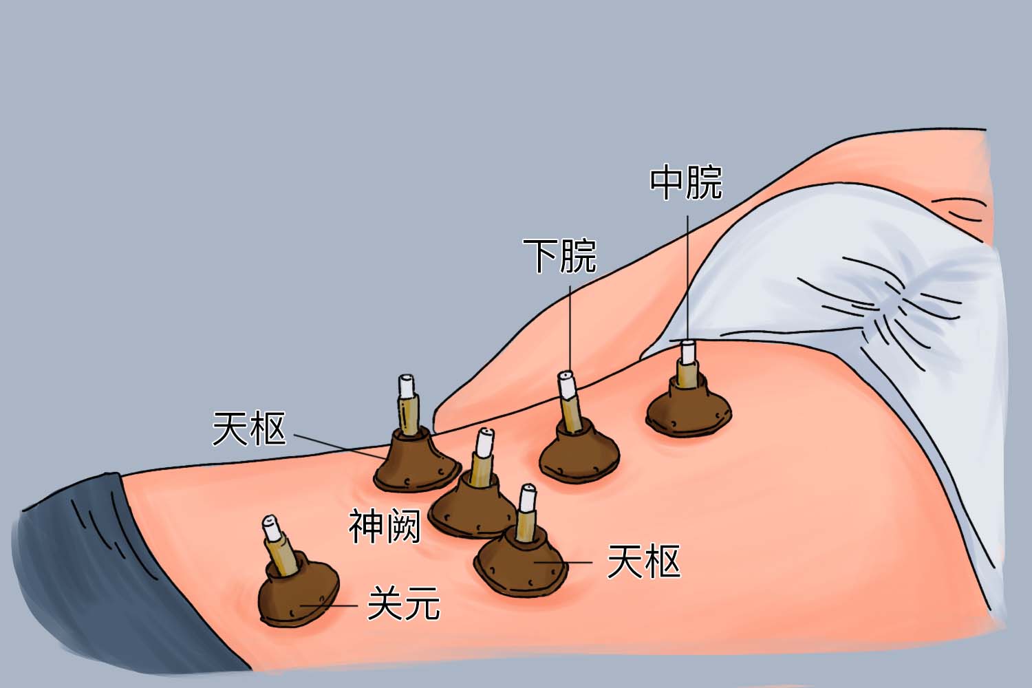 艾灸腹部位置图