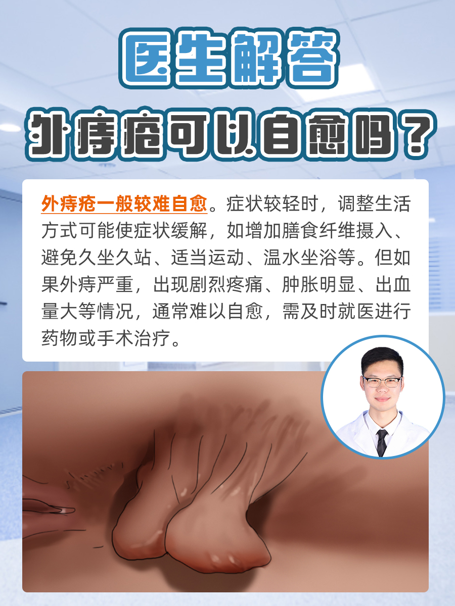 医生解答：外痔疮可以自愈吗？