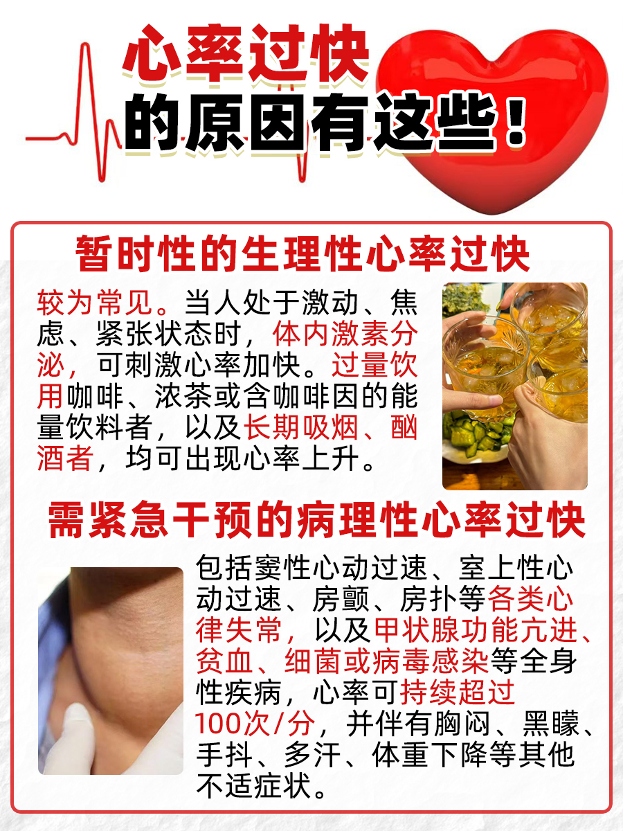 心率过快的原因是什么 ?这几种情况要格外留意