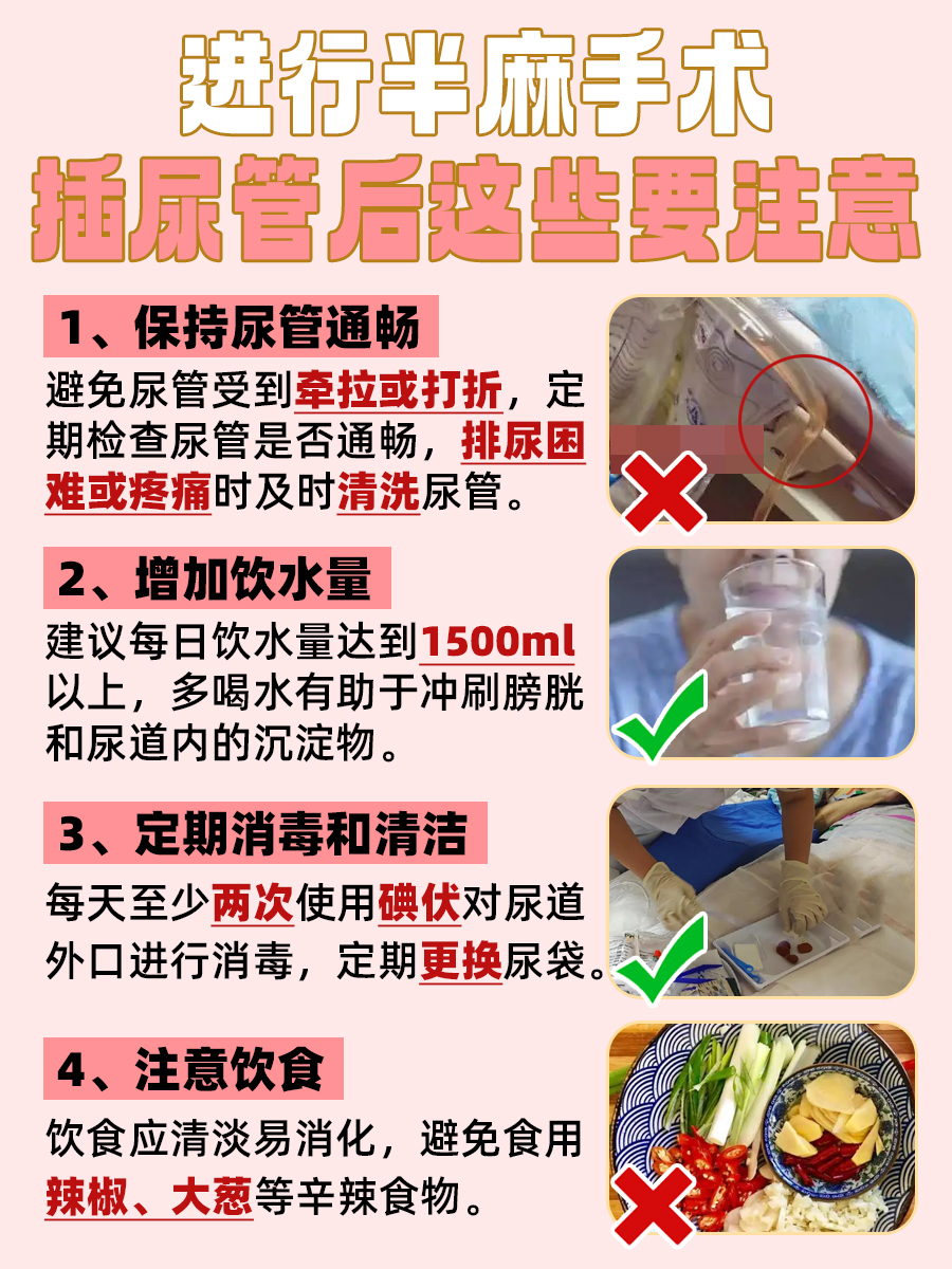 半麻手术，尿管是不是必备项？