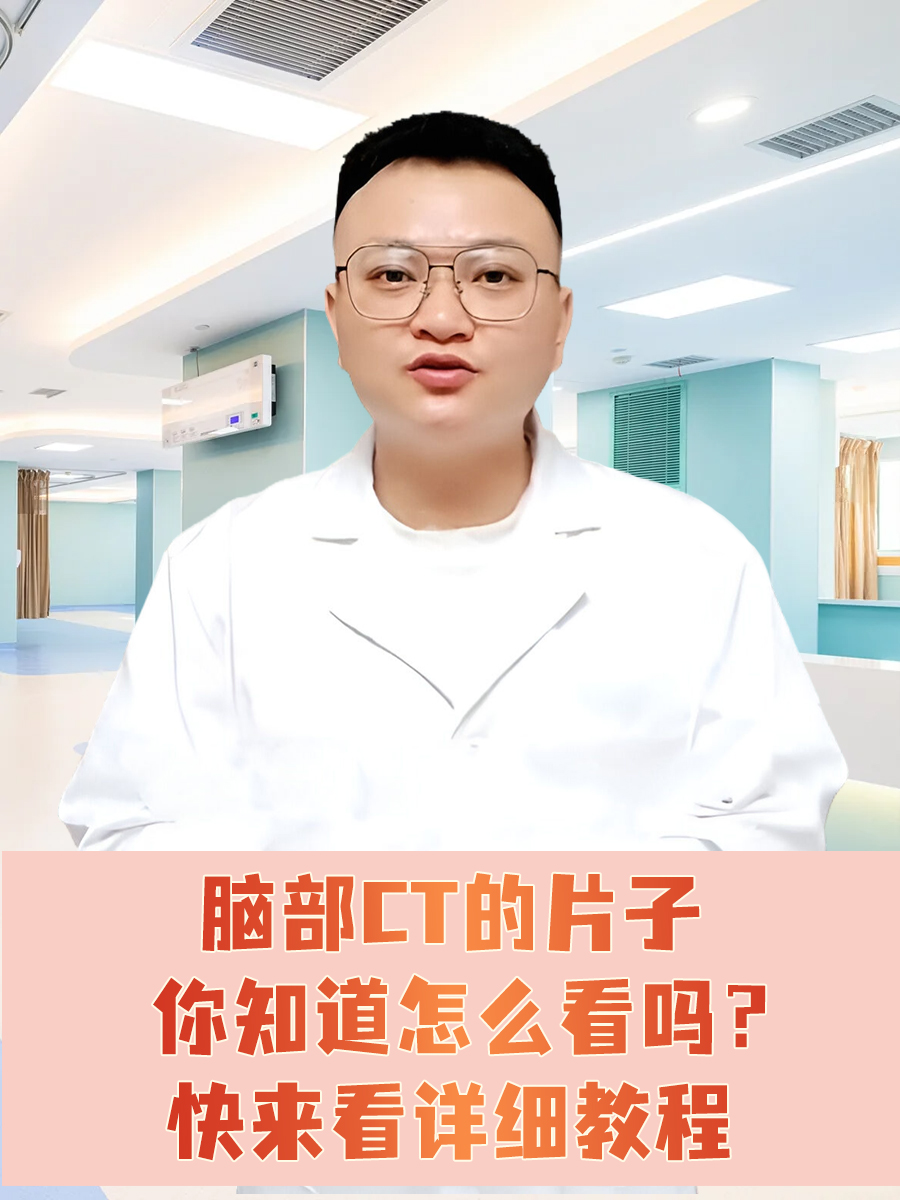 脑部CT的片子你知道怎么看吗？快来看详细教程