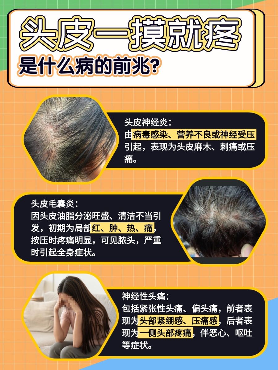 头皮一触即痛,哪些健康问题在悄悄靠近?