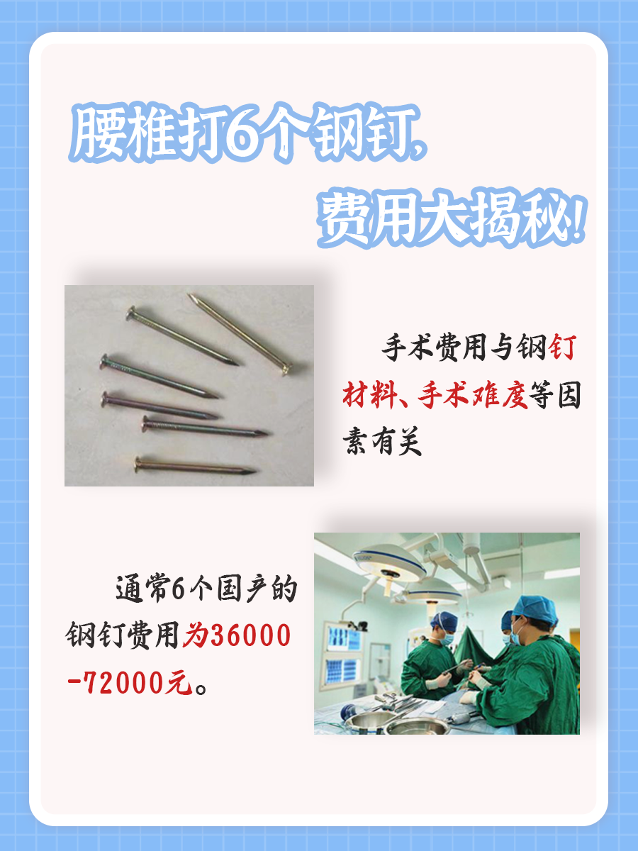 腰椎打6个钢钉,费用大揭秘!