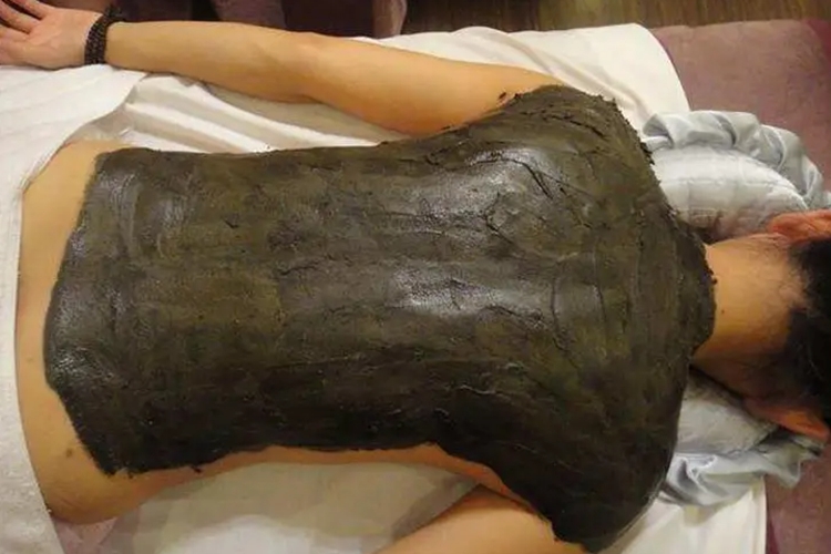 背部泥灸图