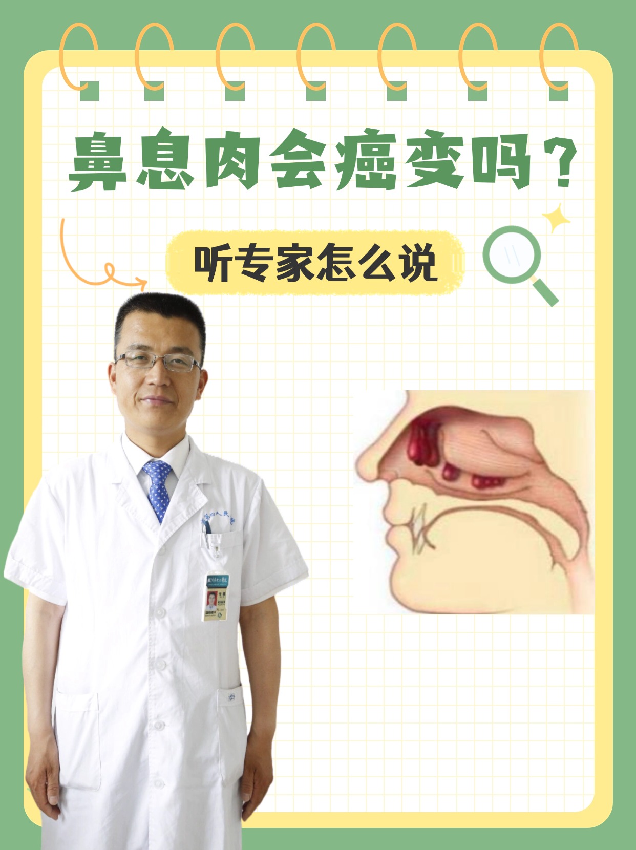 鼻息肉会癌变吗？听专家怎么说