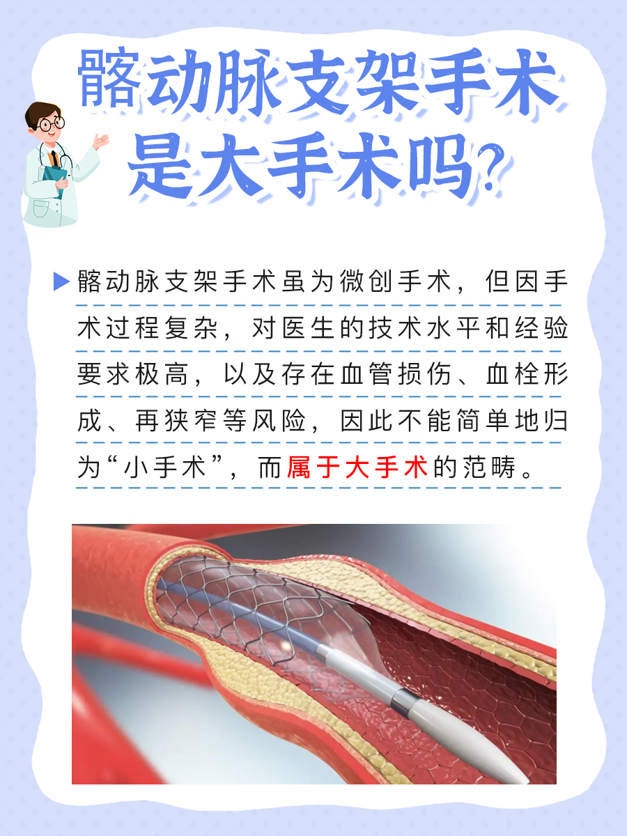 髂动脉支架手术详解：真的算“大”手术吗？