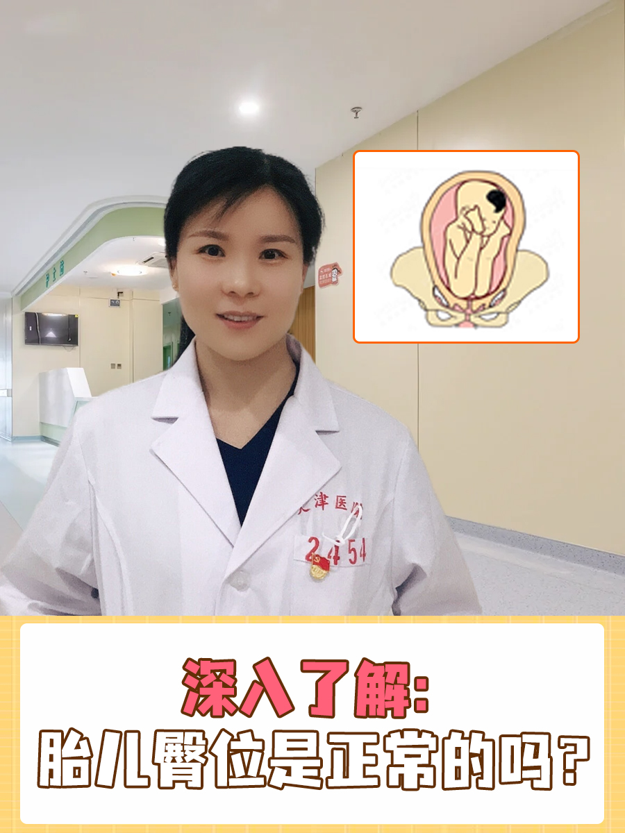 深入了解：胎儿臀位是正常的吗？