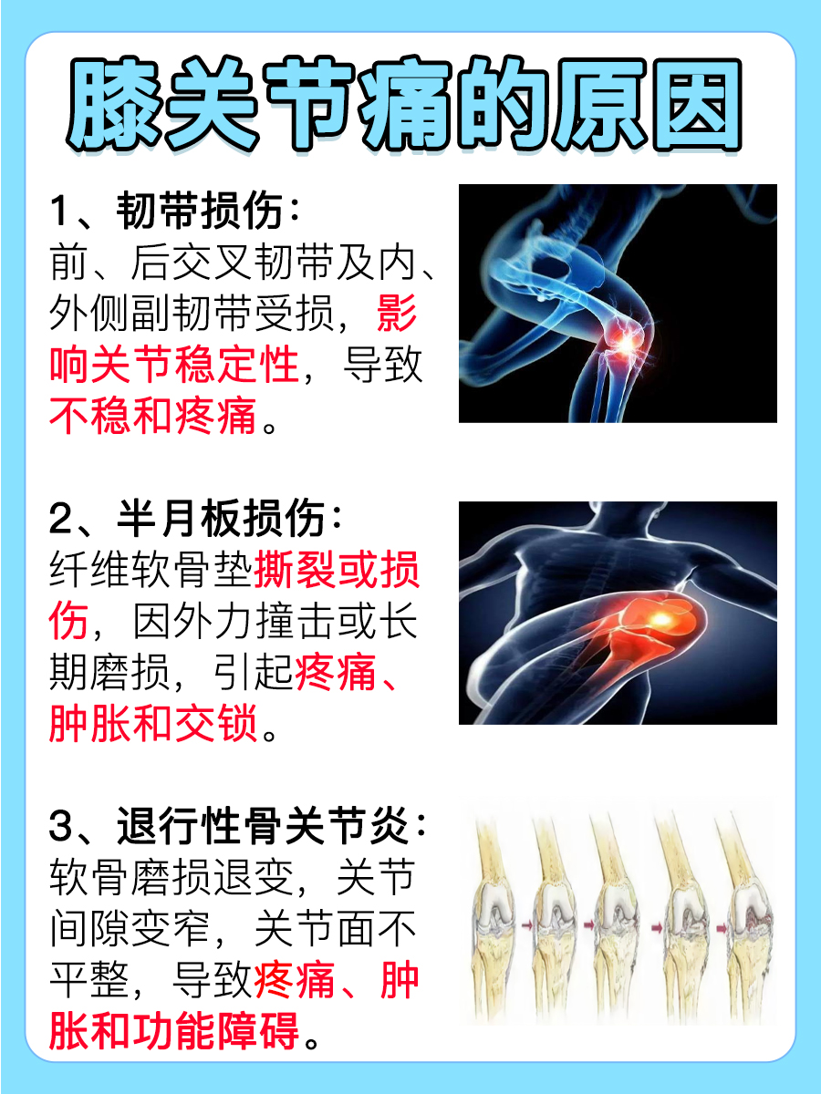 带你了解：膝关节痛怎么回事