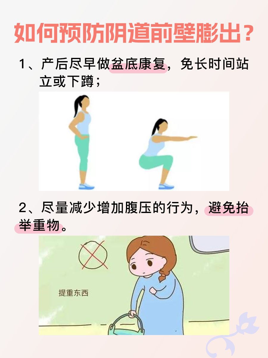 一文带你了解阴道前壁膨出的那些事儿！